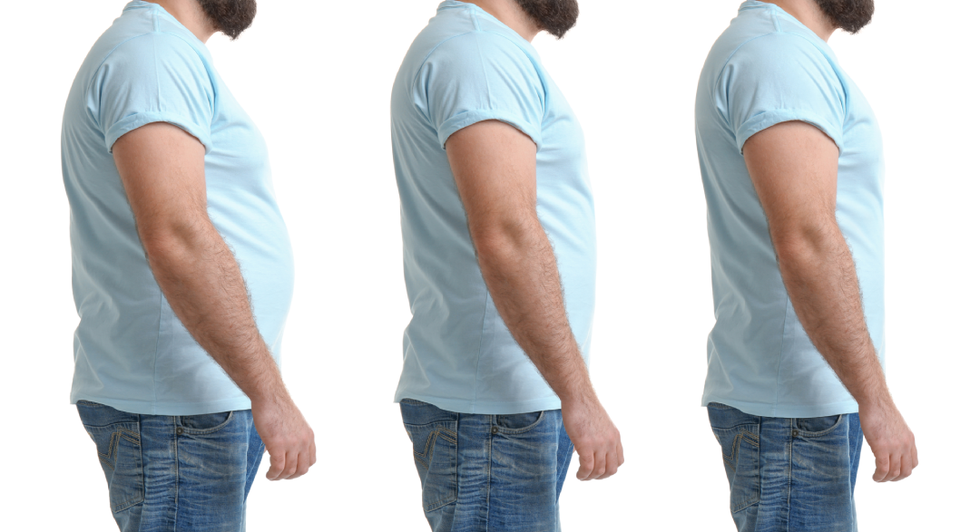 Progress stages of medical weight loss shown through a man's gradual reduction in body size over time.